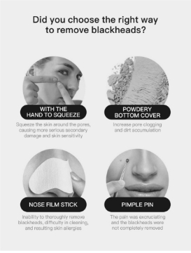 Show details for Cenocco Beauty Blackhead Remover Vacuum Picture of Cenocco Beauty Blackhead Remover Vacuum